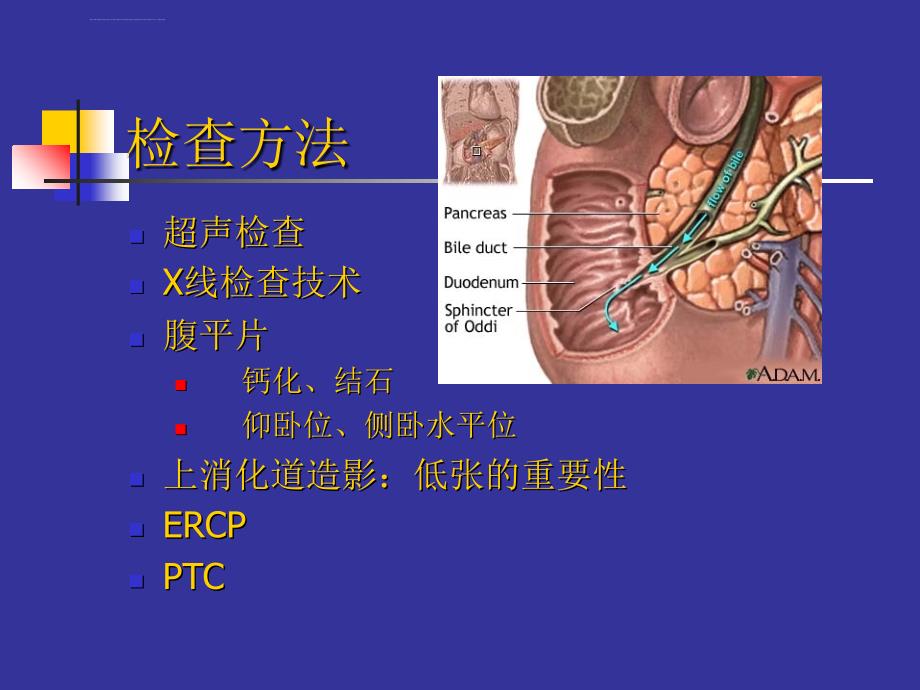 胰腺影像学ppt培训课件_第2页