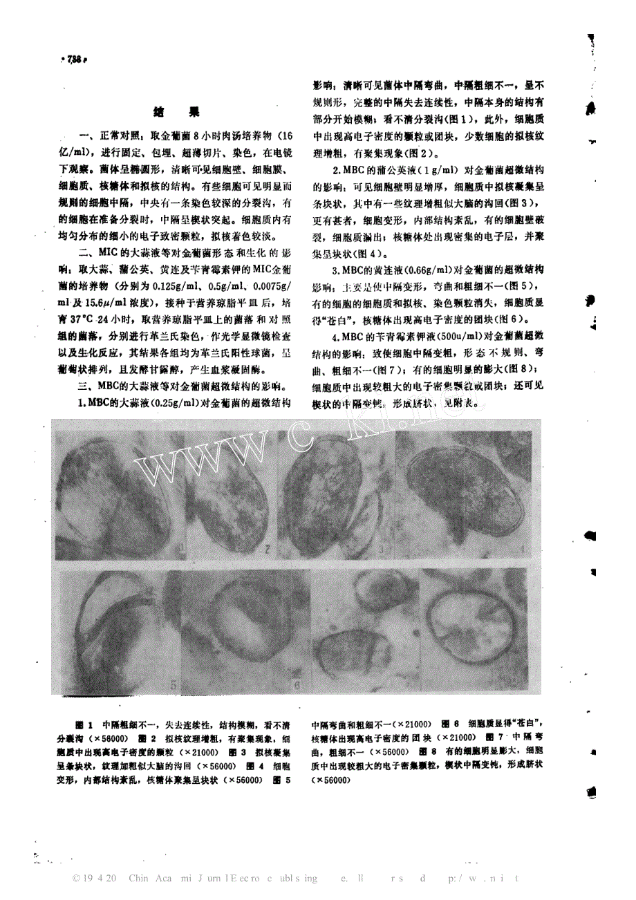 大蒜、黄连、蒲公英对金黄色葡萄球菌作用的超微结构观察_第2页