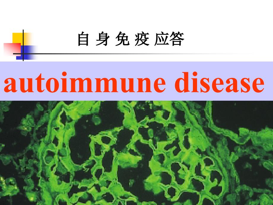 医学--自身免疫病_第1页