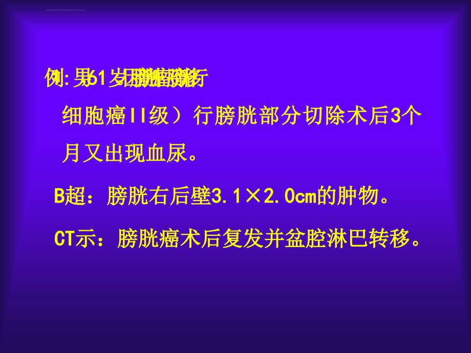 膀胱小细胞癌的诊治及预后ppt培训课件_第3页