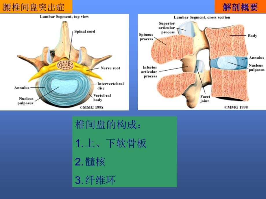 腰椎间盘突出症的诊断和治疗ppt课件_第5页