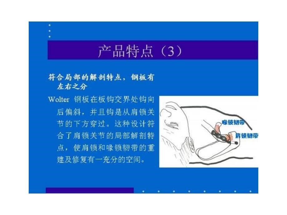 肩锁关节钩板ppt培训课件_第5页