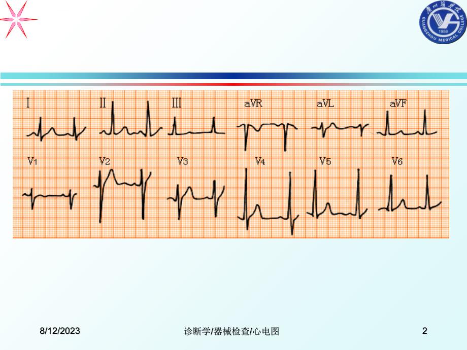 心电图课件ppt课件_第2页