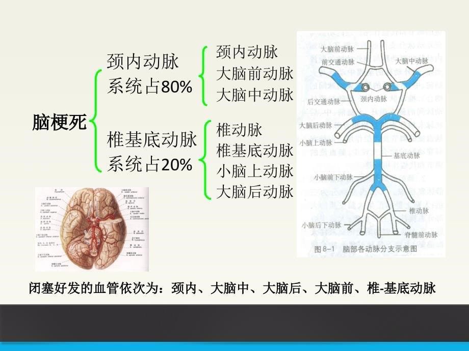 脑梗死康复训练课件课件_第5页