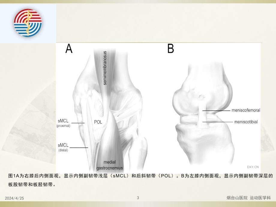2017coa发言膝关节后内侧结构损伤ppt课件_第3页