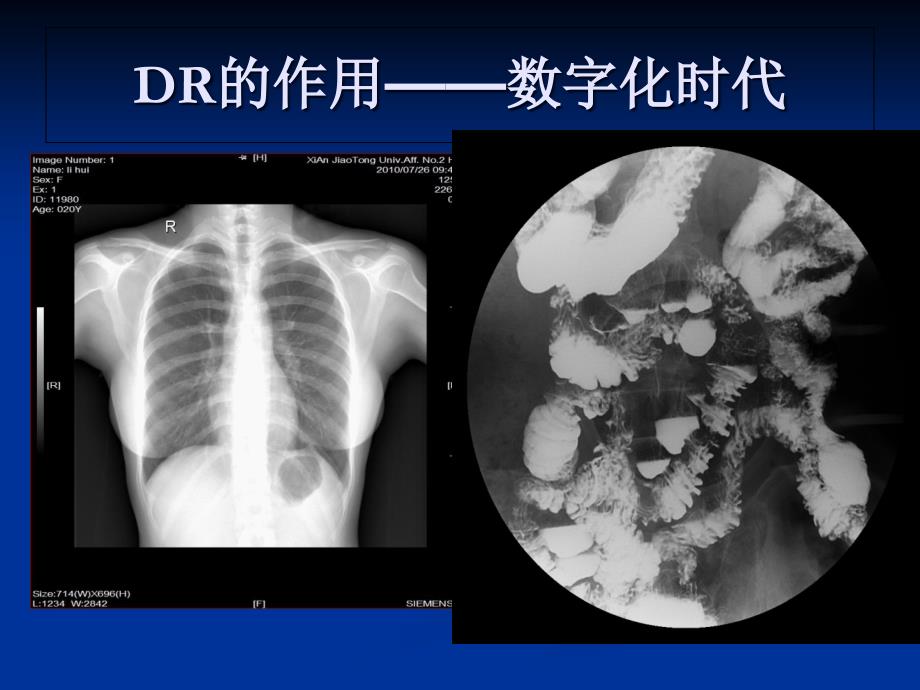 影像学的艺术与哲学讲课稿_第3页