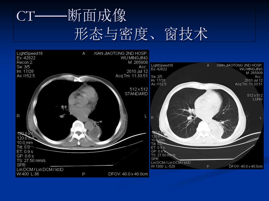 影像学的艺术与哲学讲课稿_第4页