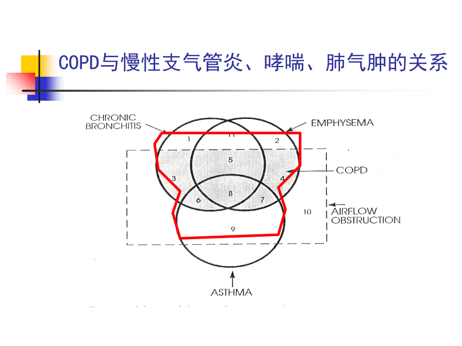 重庆医科大学_廖勤《临床医学概论》呼吸系统疾病之第二篇第六章慢性阻塞性肺疾病_第4页