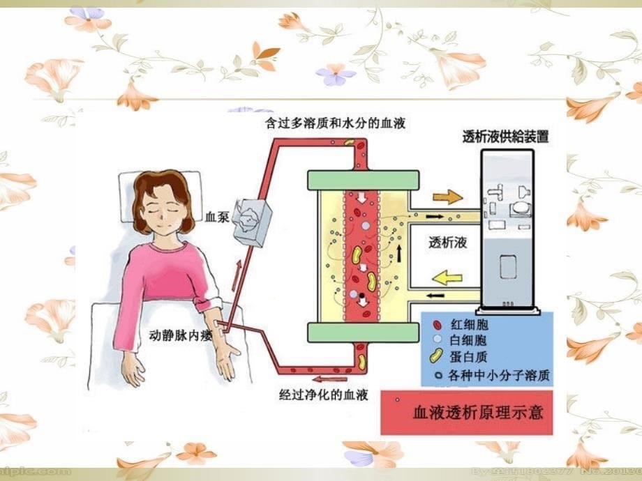 血液净化技术（包括人工肝技术）_第5页