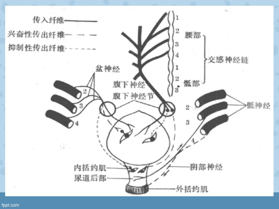 骨折病人术后尿潴留的护理课件_第4页