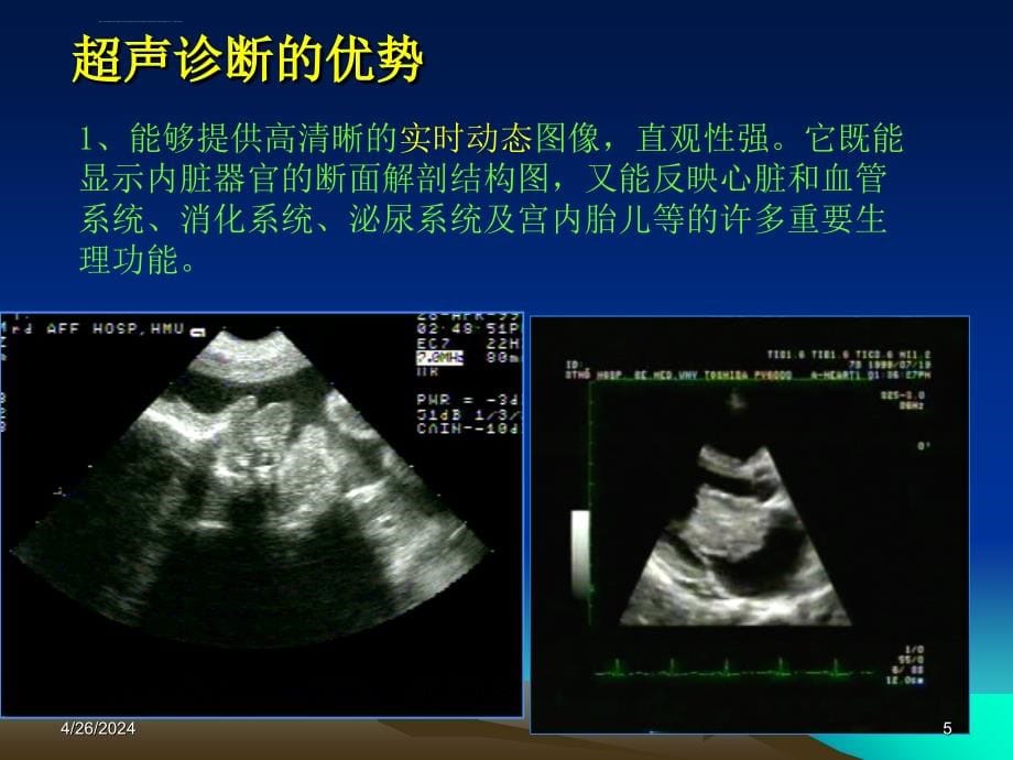 超声诊断物理基础课件_第5页