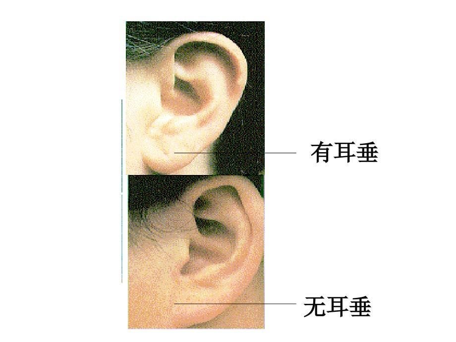 八年级生物基因控制生物的性状2_第5页