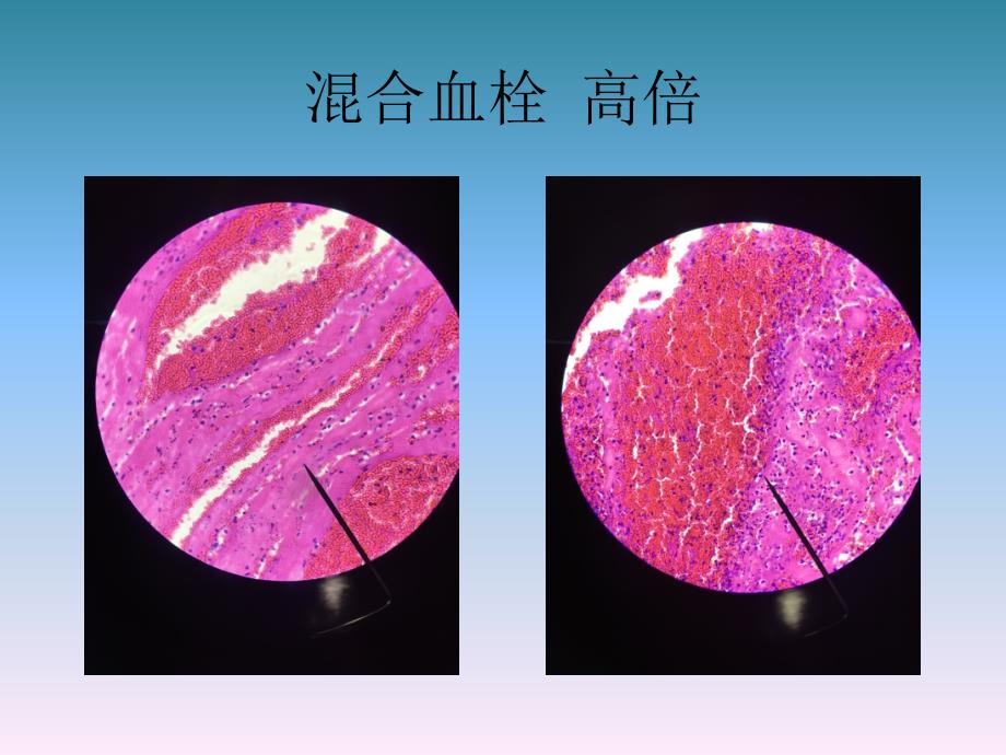 病理学照片03_第4页