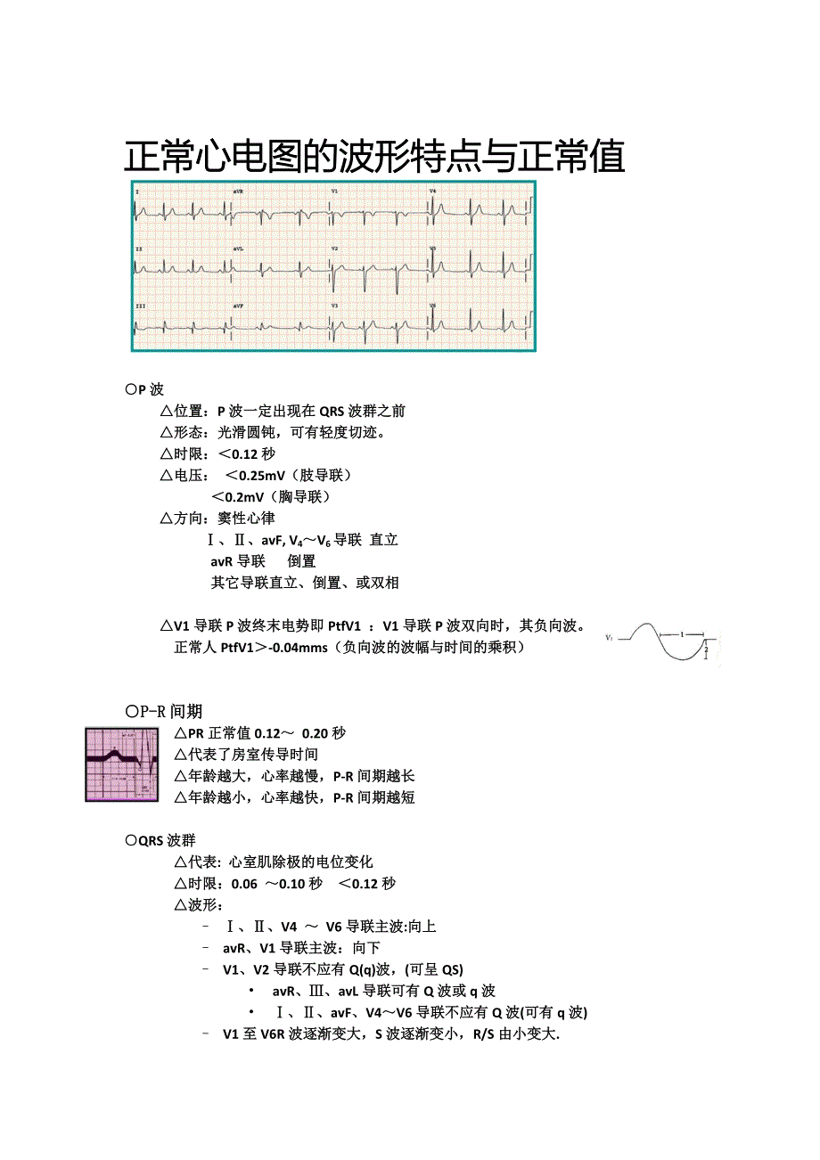 ECG1—心电图重点知识总结_第4页