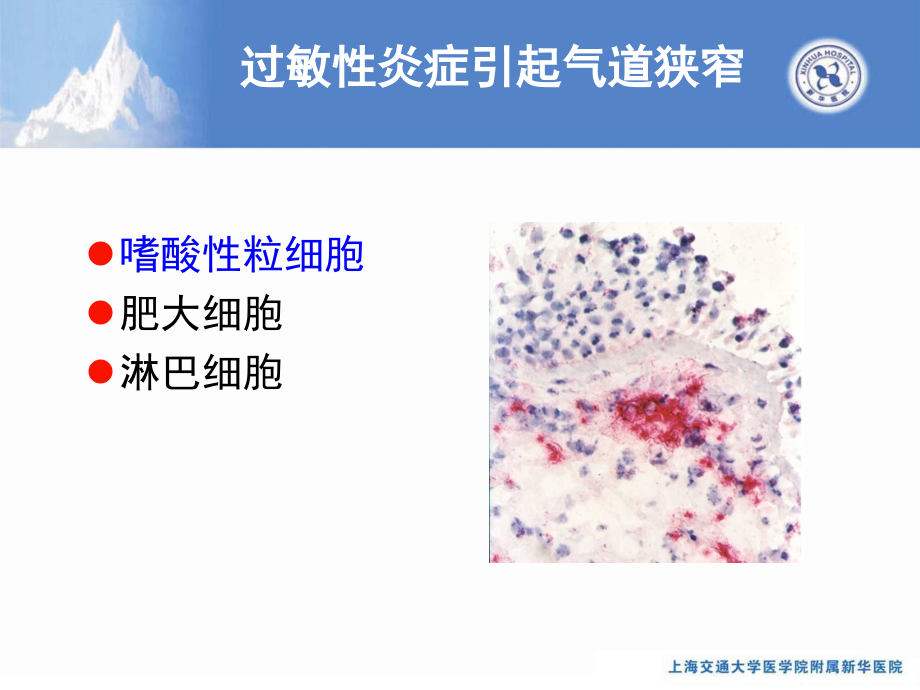 婴幼儿喘息及急性期联合降阶梯疗法的建立和优化研究_第4页