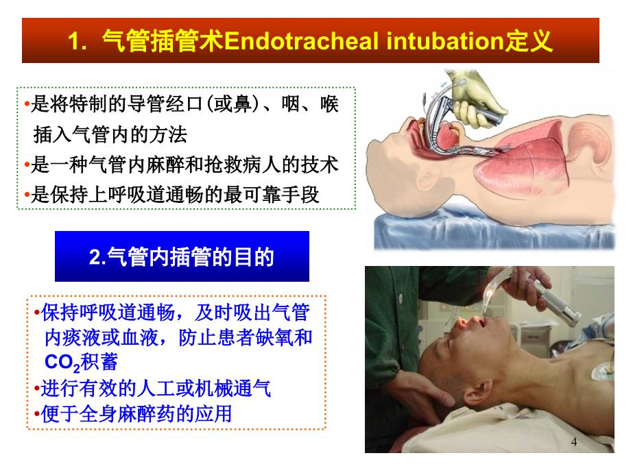 气管插管通道的应用解剖PPT课件_第4页