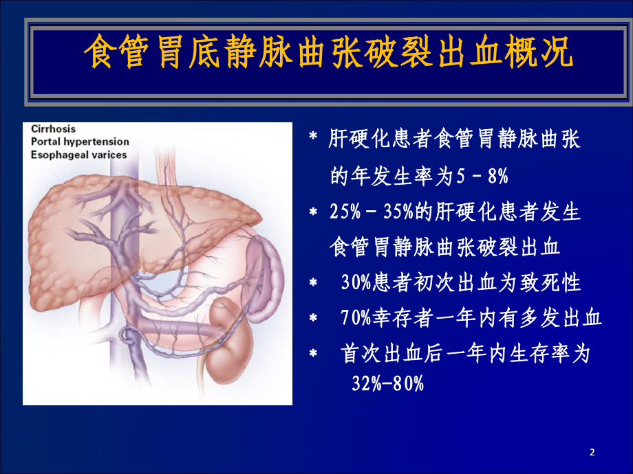 浅析食管胃底静脉曲张破裂出血的各种预防措施PPT课件_第2页
