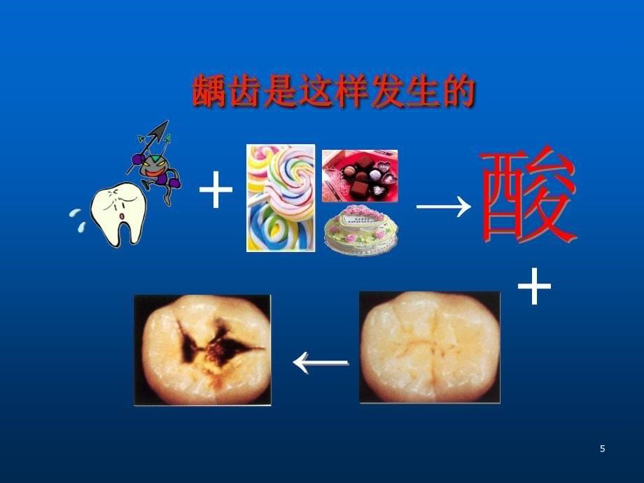 儿童牙齿保健ppt课件_第5页