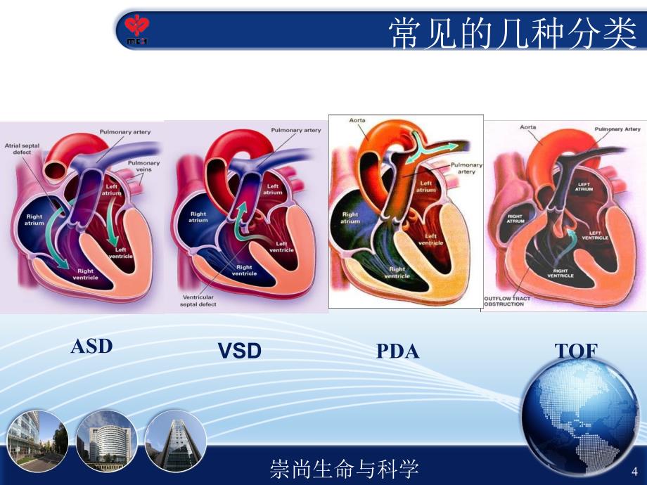 介入术后护理PPT课件_第4页