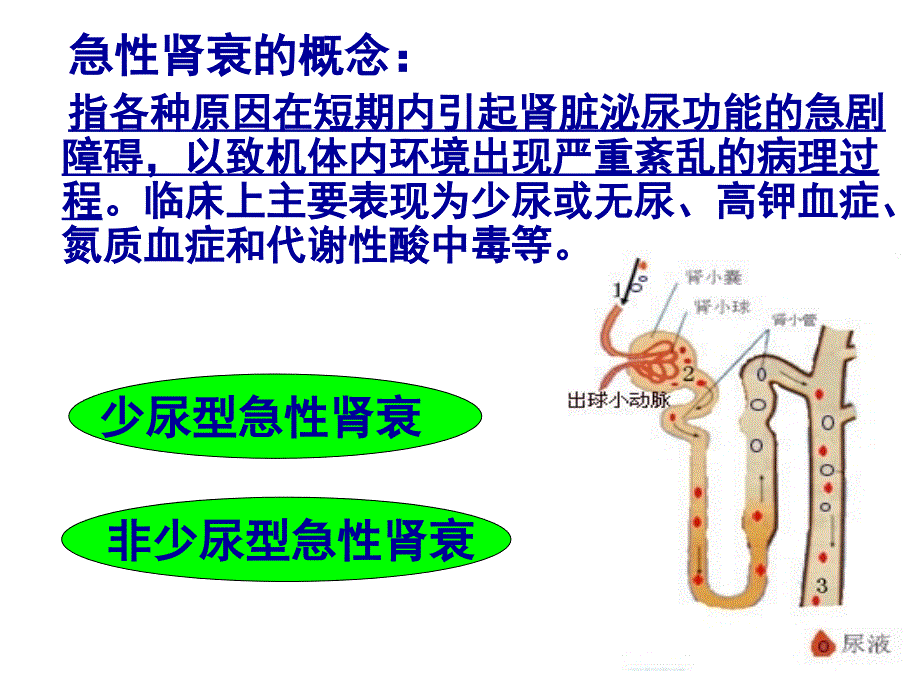 急性肾功能衰竭的病因和分类ppt课件_第4页