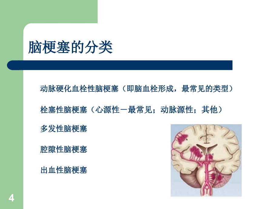 急性脑梗塞的溶栓治疗业务学习ppt课件_第4页