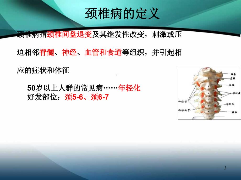 颈椎病护理查房PPT课件_第3页