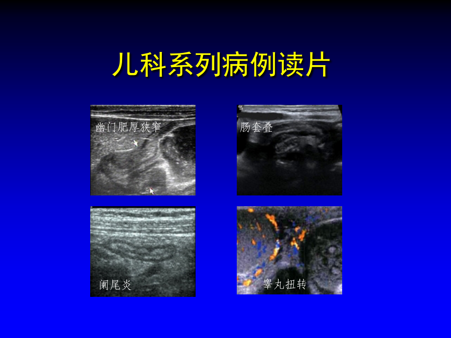 儿科病例读片ppt课件_第3页