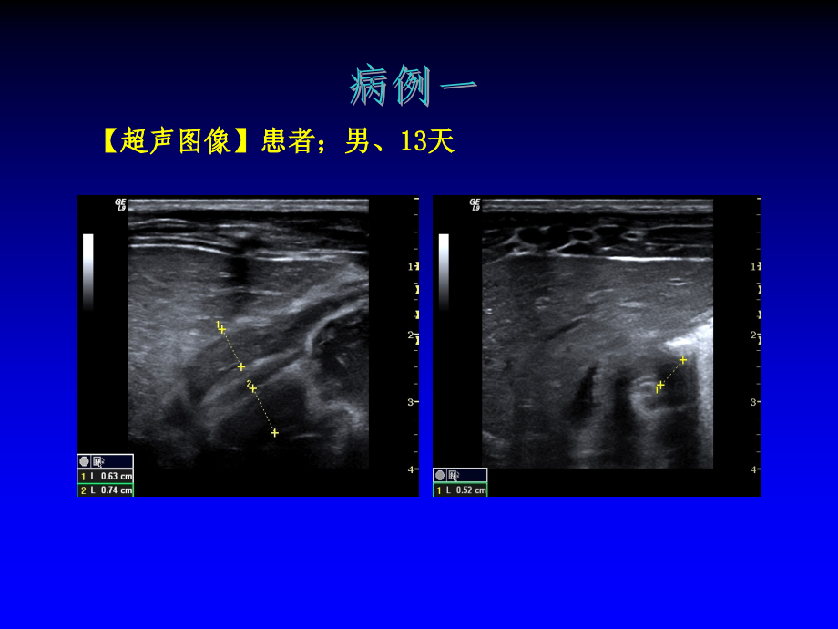 儿科病例读片ppt课件_第4页