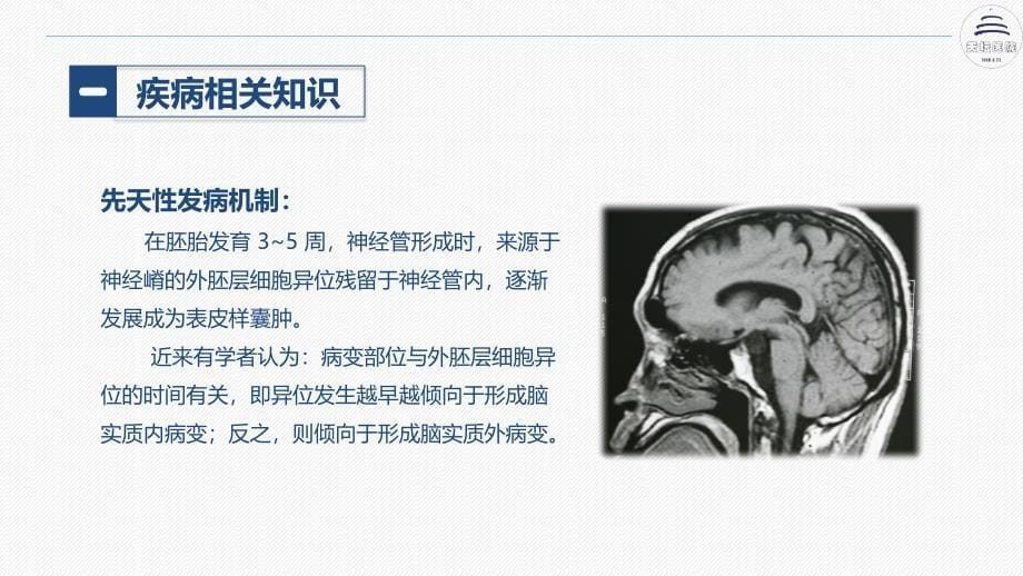 颅内表皮样囊肿患者的护理查房ppt课件_第5页