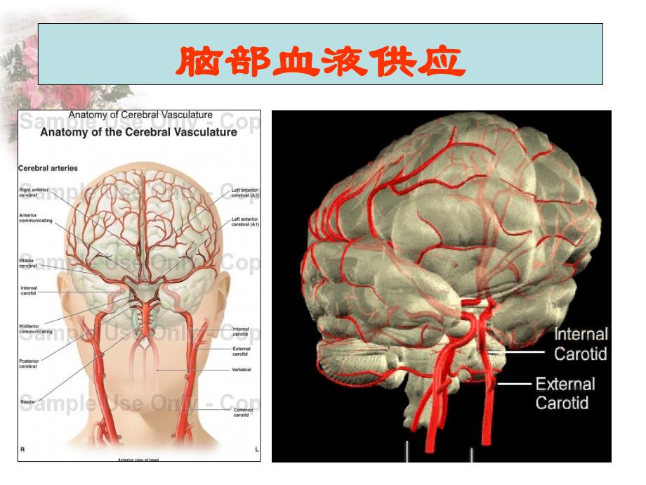 缺血性脑血管病脑梗塞ppt课件_第4页