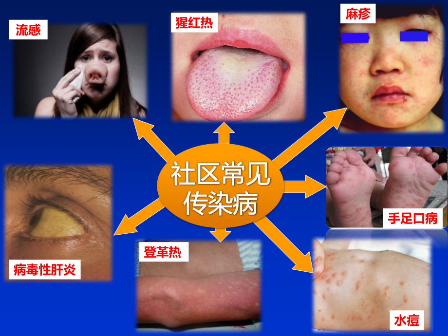 社区传染病初步诊断ppt课件_第2页