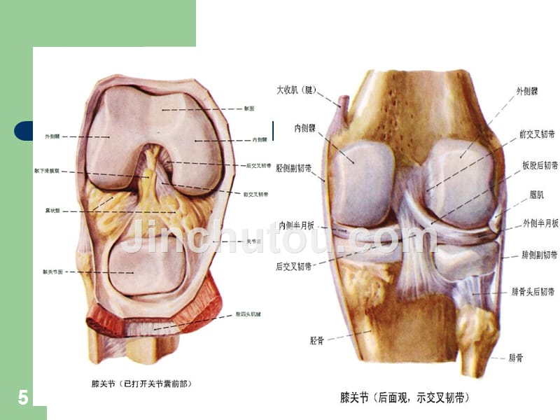 人工膝关节置换术治疗骨性关节炎的ppt课件_第5页