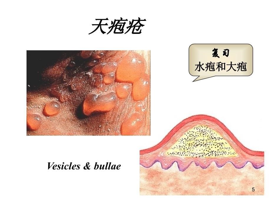 皮肤学天疱疮ppt课件_第5页