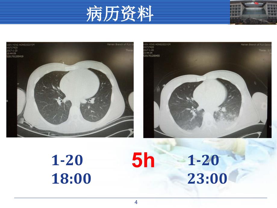 吸入性肺损伤ppt课件_第4页