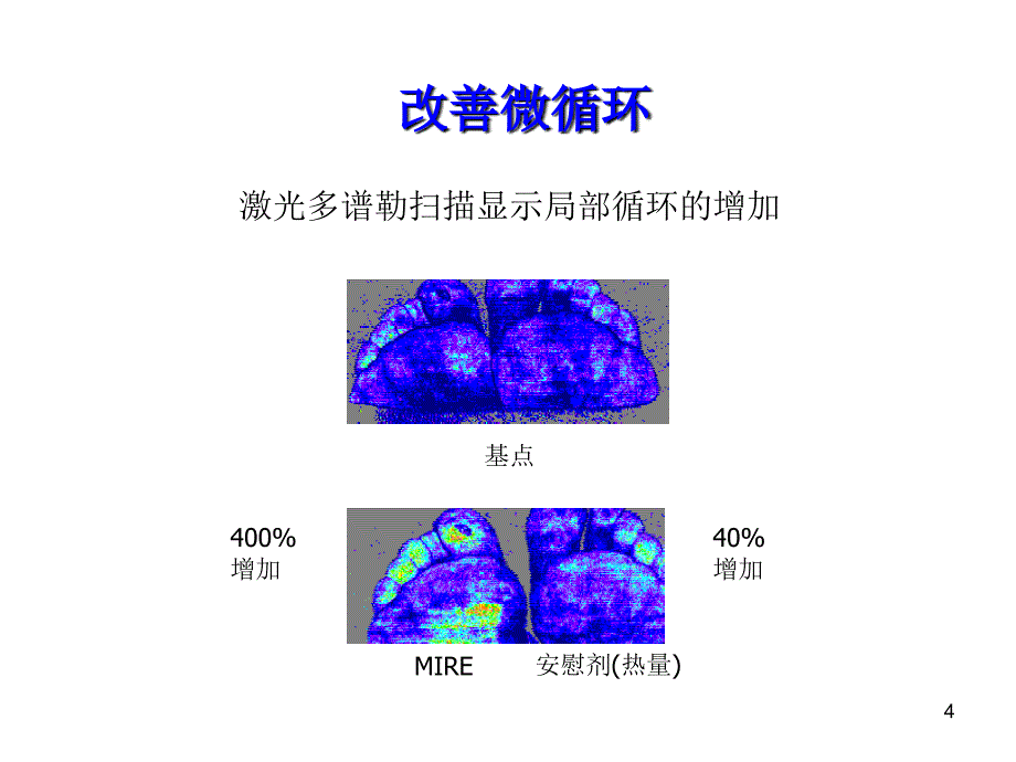 糖尿病足神经血管治疗仪ppt课件_第4页