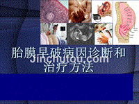 胎膜早破病因诊断和治疗方法PPT课件