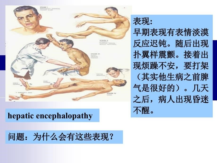 病理生理学绪论学习.ppt_第5页