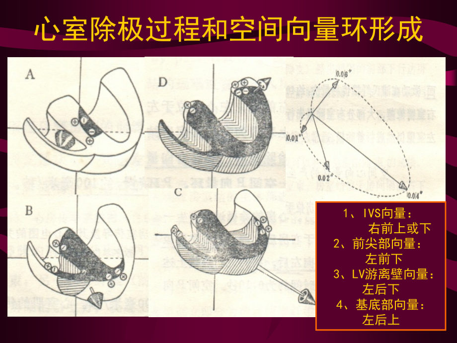 常见心电图 ppt_第3页