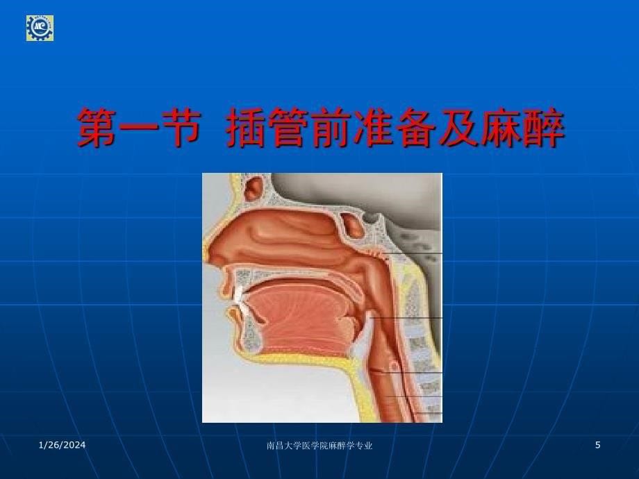 全身麻醉和气管插管（ppt x页）_第5页