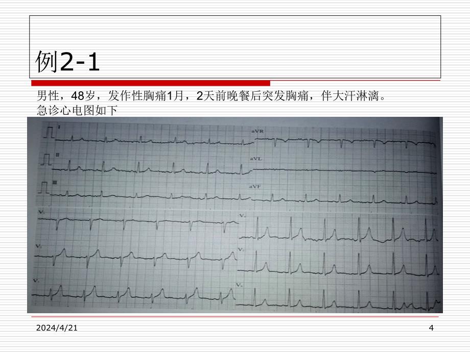 心电图系列讲座2ppt_第4页