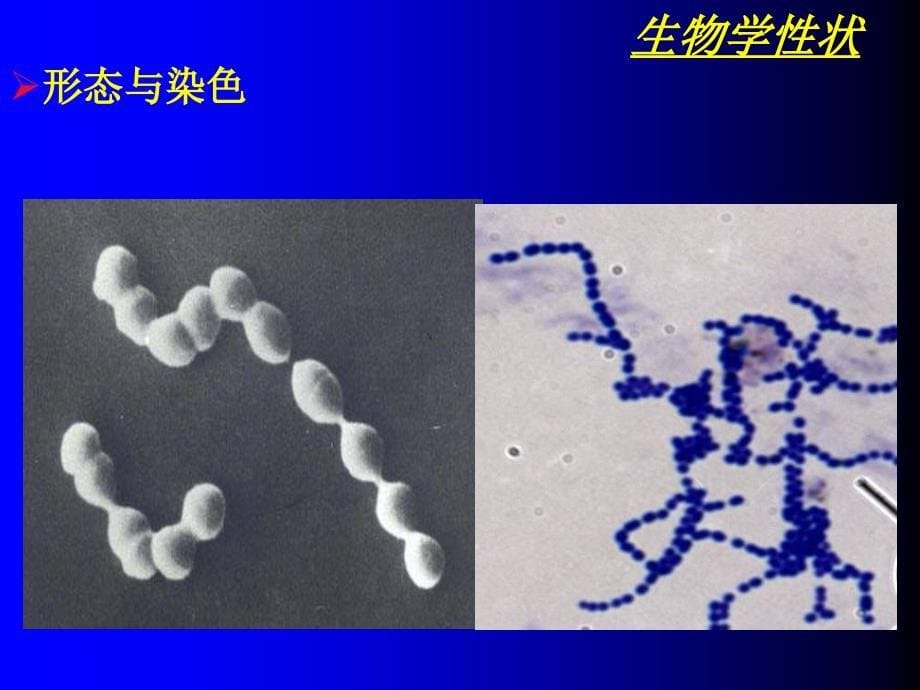 【大学课件】医学微生物学----lqj_第5页