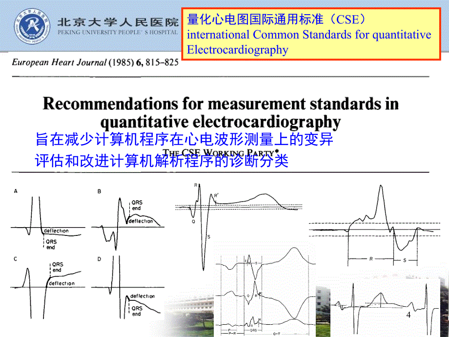 张海澄 从2009心电专家共识看心电图规范化_第4页
