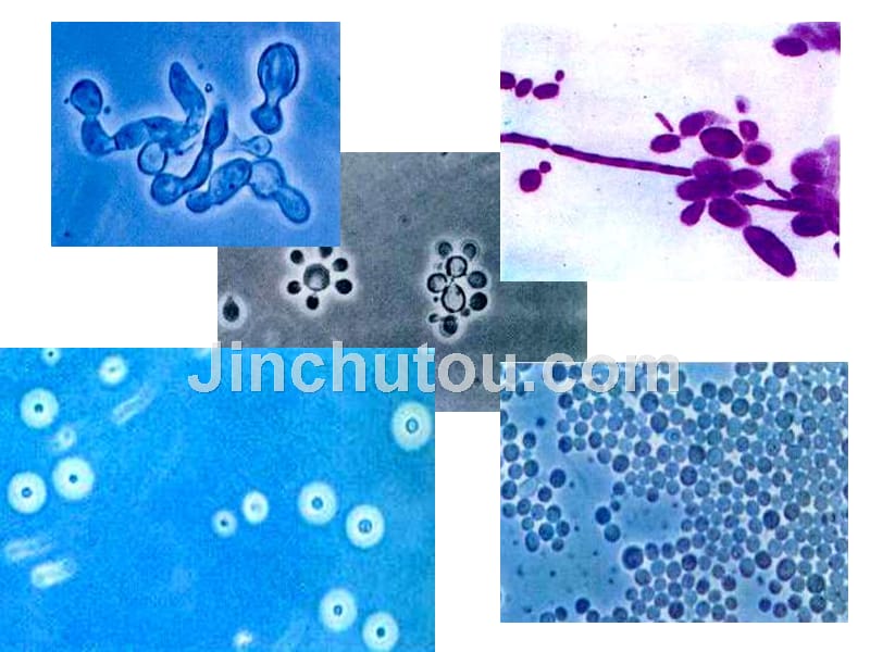 【大学课件】医学微生物学法文-----21_第3页