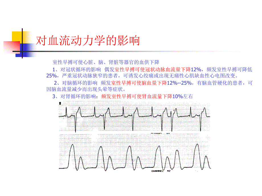 卢喜烈 室性早搏与猝死2010-04-11_第4页