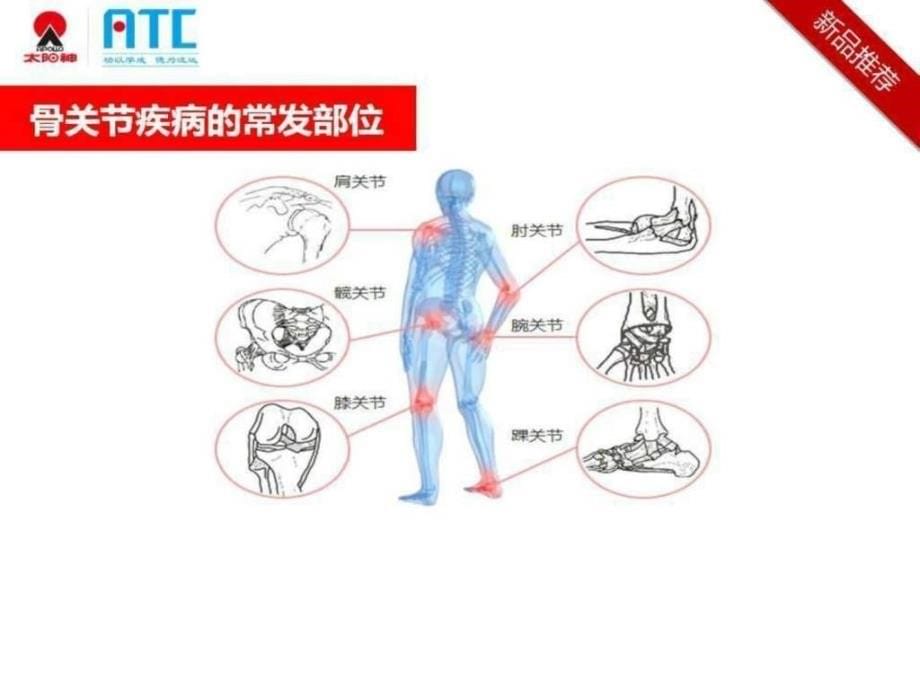 增加骨密度胶囊_图文_第5页