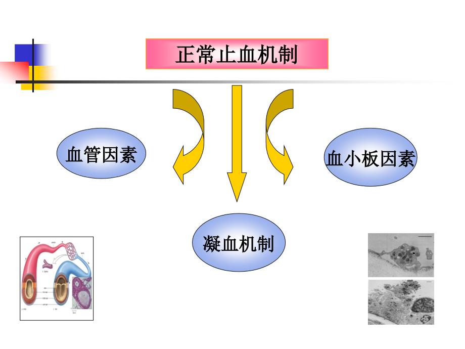 出血性疾病10_第3页