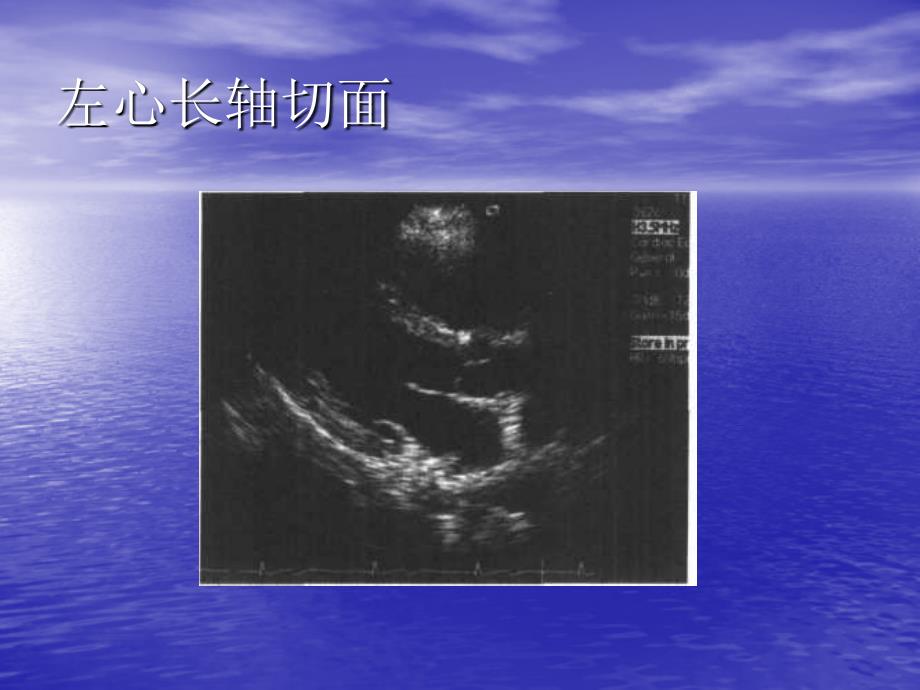 正常超声心动图及检查方法_基础医学_医药卫生_专业资料 - 心脏_图文_第3页