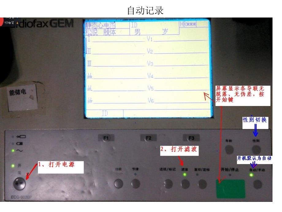 常见心电图诊断。2015.05_第3页