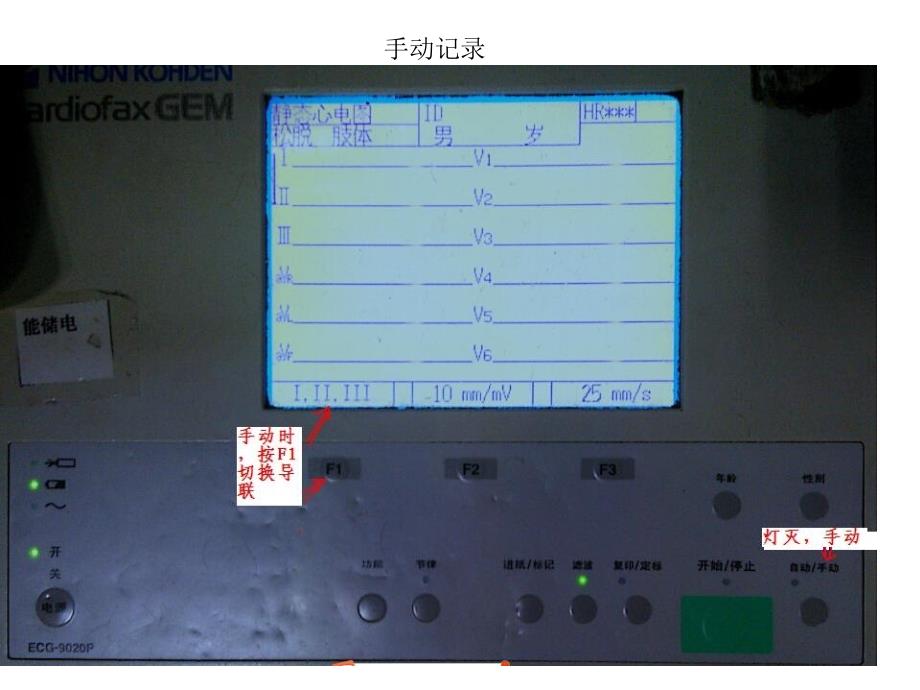 常见心电图诊断。2015.05_第4页