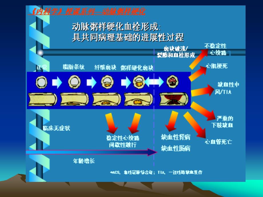 重视周围动脉疾病_第4页